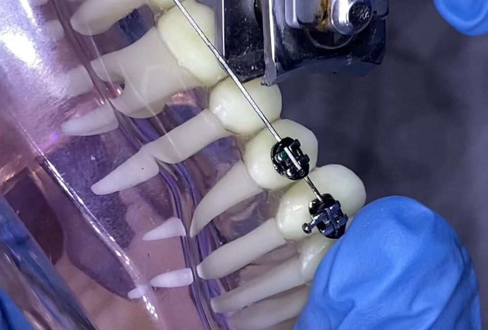 Comment couper un arc qui blesse